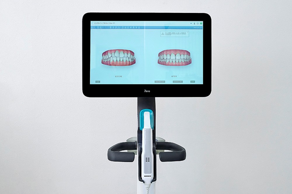 無料シミュレーションも行っております