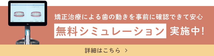 矯正治療による歯の動きを事前に確認できて安心 無料シミュレーション実施中！